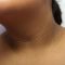 SEE THE COLOUR OF THE SKIN OVERLYING THIS WOMAN’S NECK! ANSWER WHY!