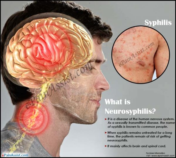 How Does Syphilis Affect The Brain