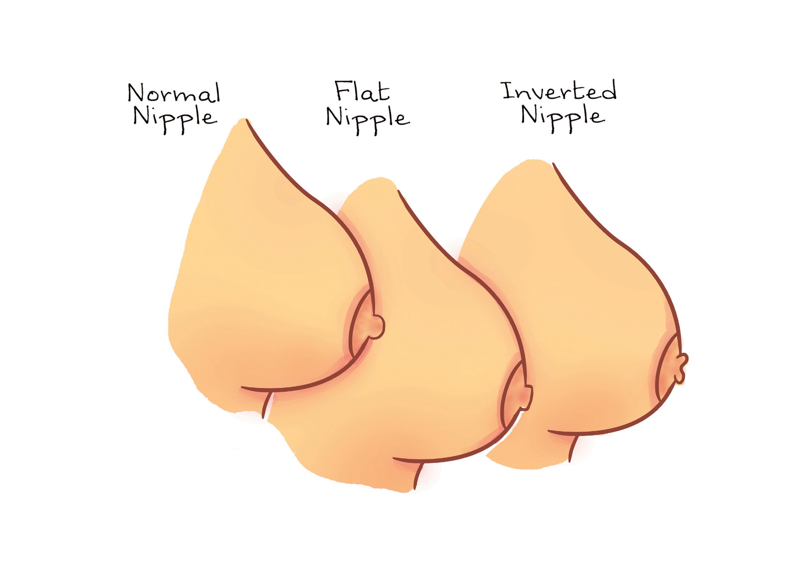 https://www.healthgist.net/media/nipple-shapes-scaled.jpg
